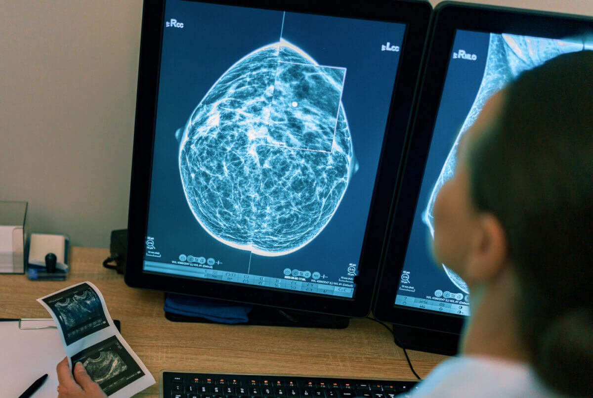 Technician reviewing a mammogram image onscreen