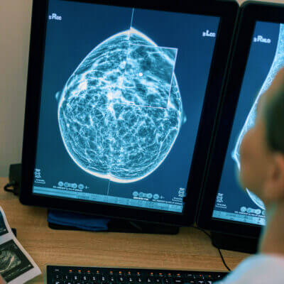 Technician reviewing a mammogram image onscreen