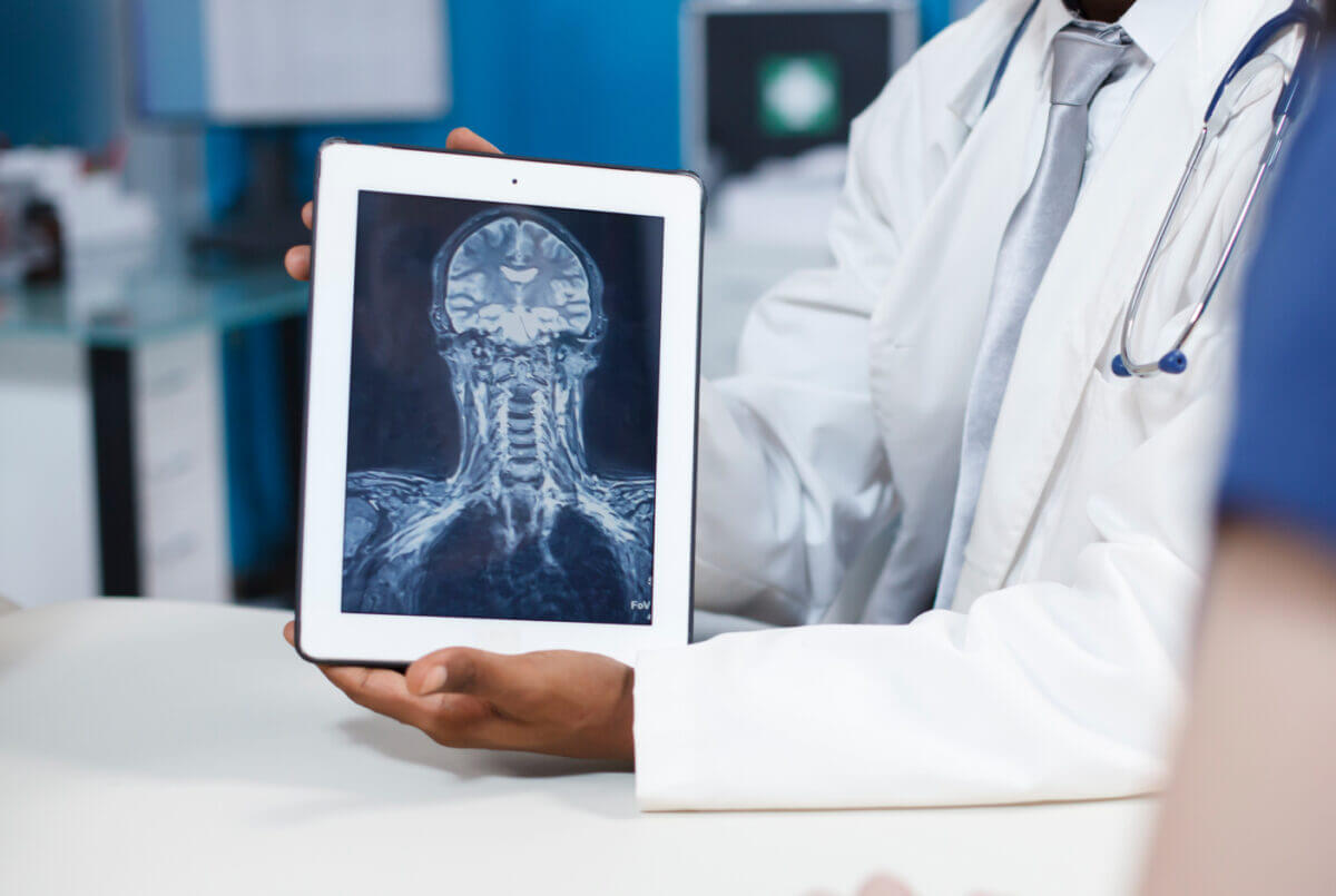 Doctor examining a head and neck x-ray on a tablet computer
