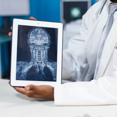 Doctor examining a head and neck x-ray on a tablet computer